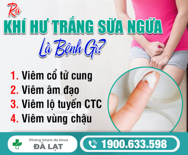Hình ảnh minh họa